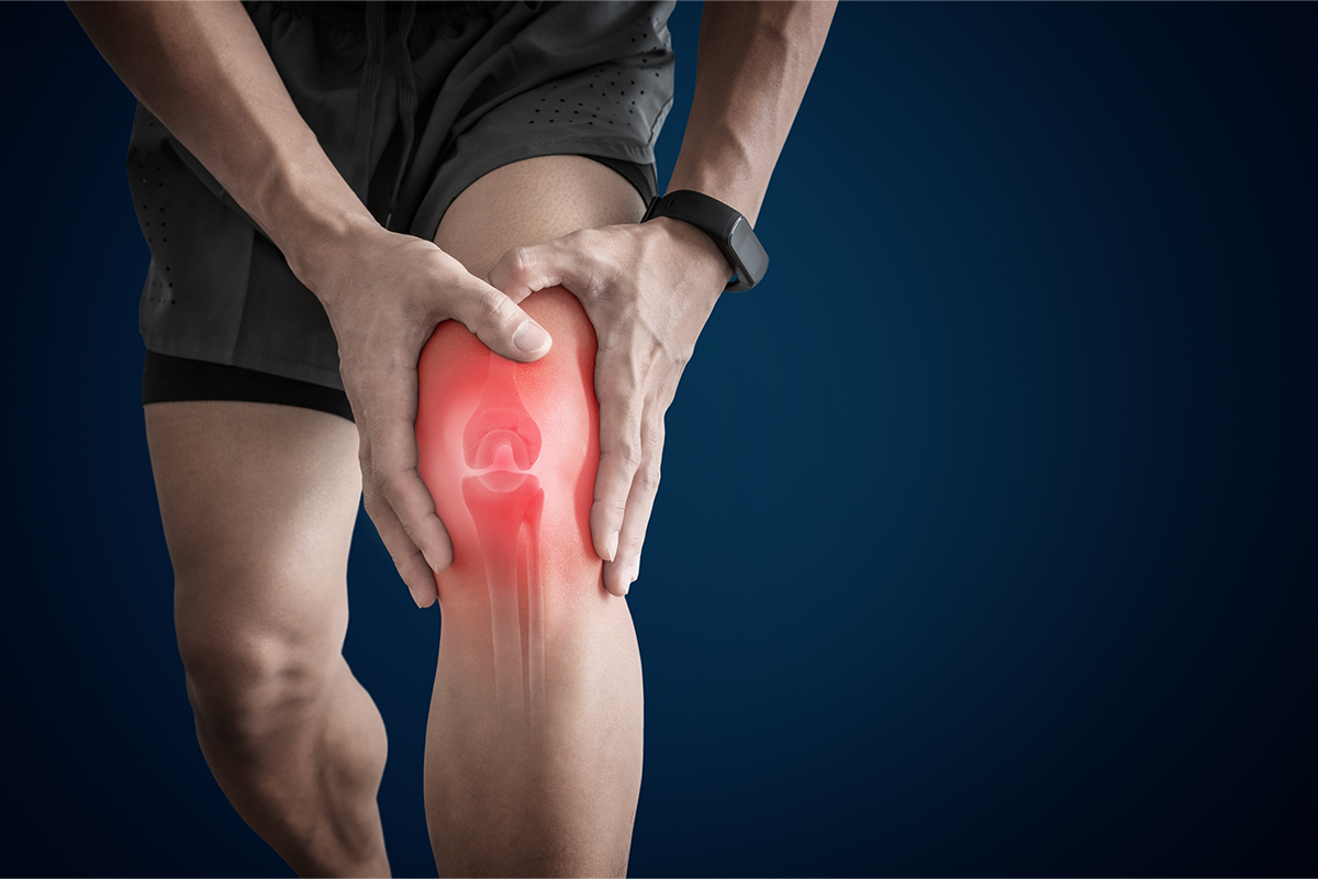 Knee Arthroscopy